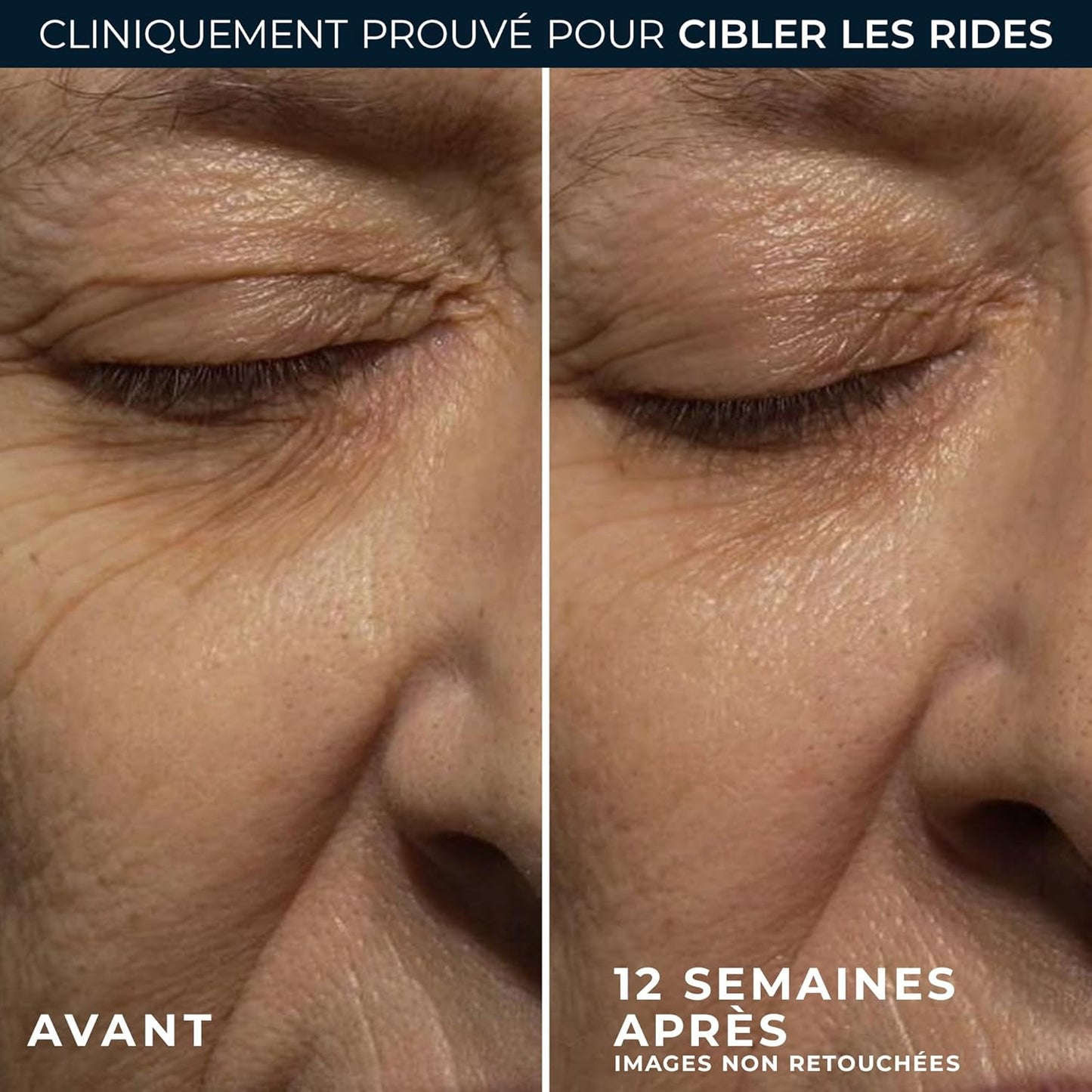 RoC - Retinol Correxion Wrinkle Correct Crème de Nuit - Anti-Rides et Age - Peau Revitalisée - Rétinol et Complexe Minéral Exclusif - 30 ml