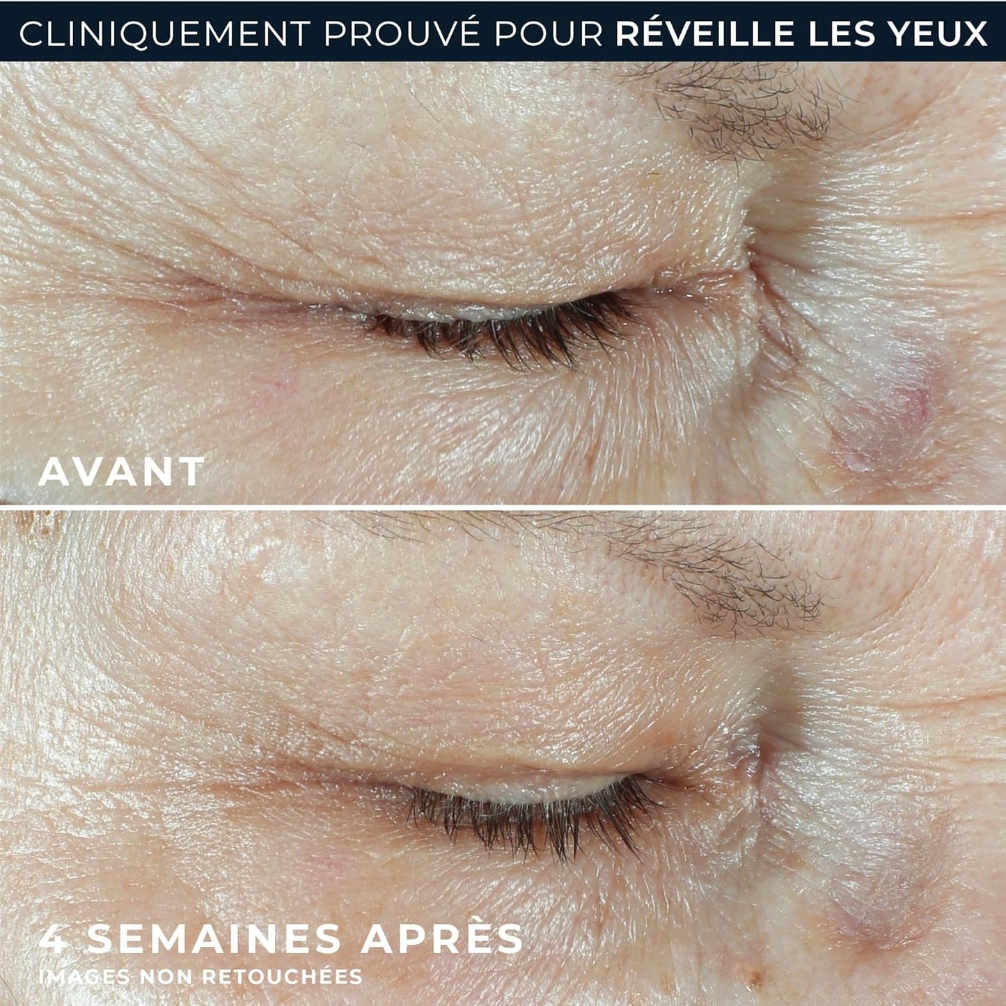 RoC - Multi Correxion Hydrate + Plump Sérum - Pour L'hydratation de la Peau - Effet Repulpant Maximal - Acide Hyaluronique - 10 Capsules